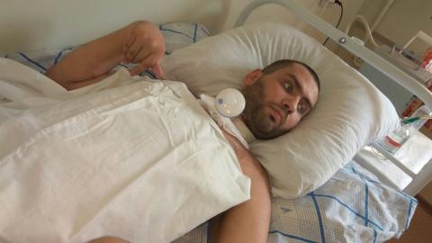 Переживший кому после удаления зуба житель Бердска снова в больнице
