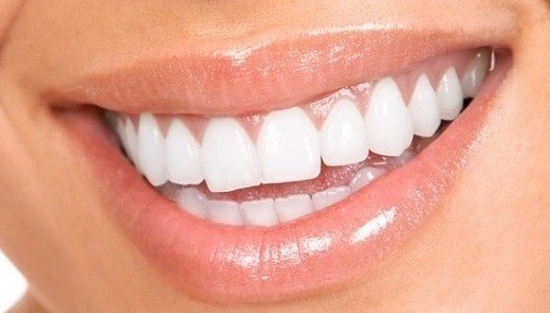  Натуральное отбеливание зубов